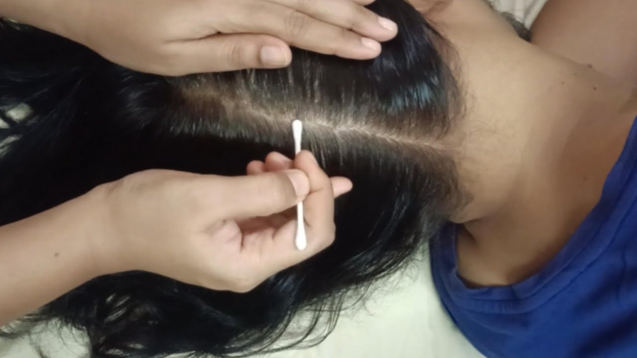 Detailed Scalp Exam and Treatment ASMR (Real Person)