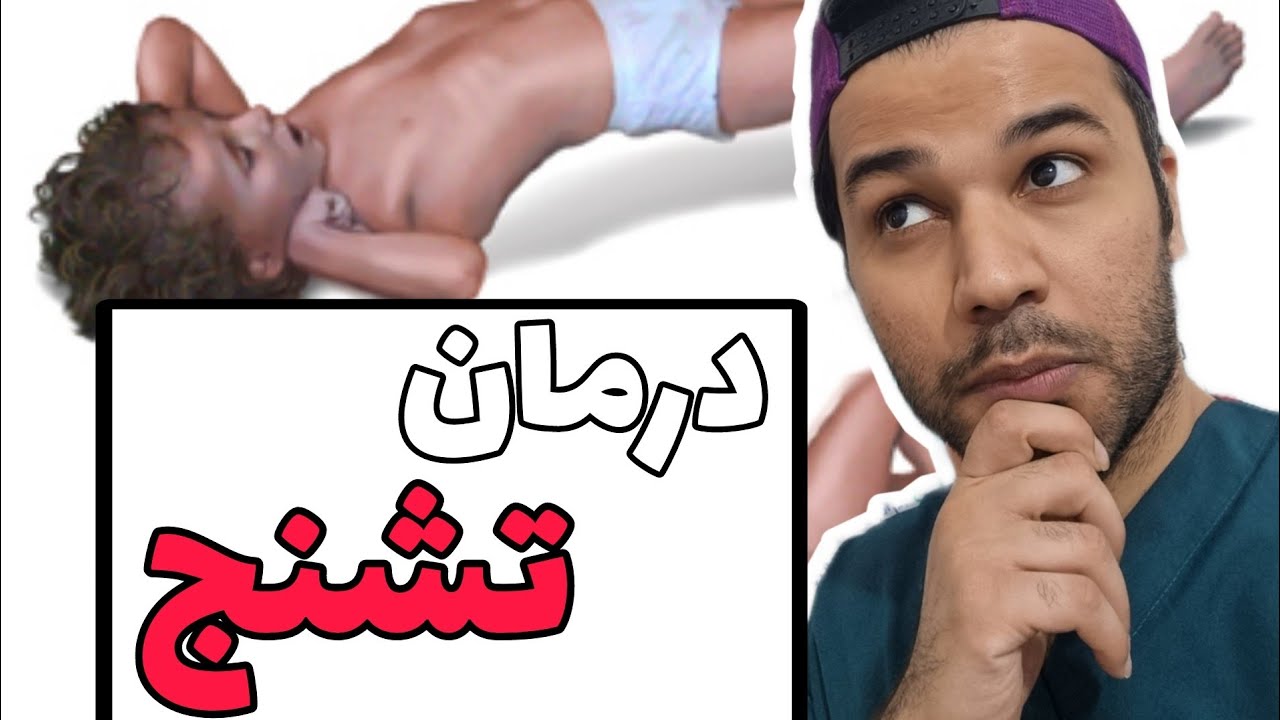 انواع تشنج و نحوه درمان تشنج| different types of seizure and how to treat them