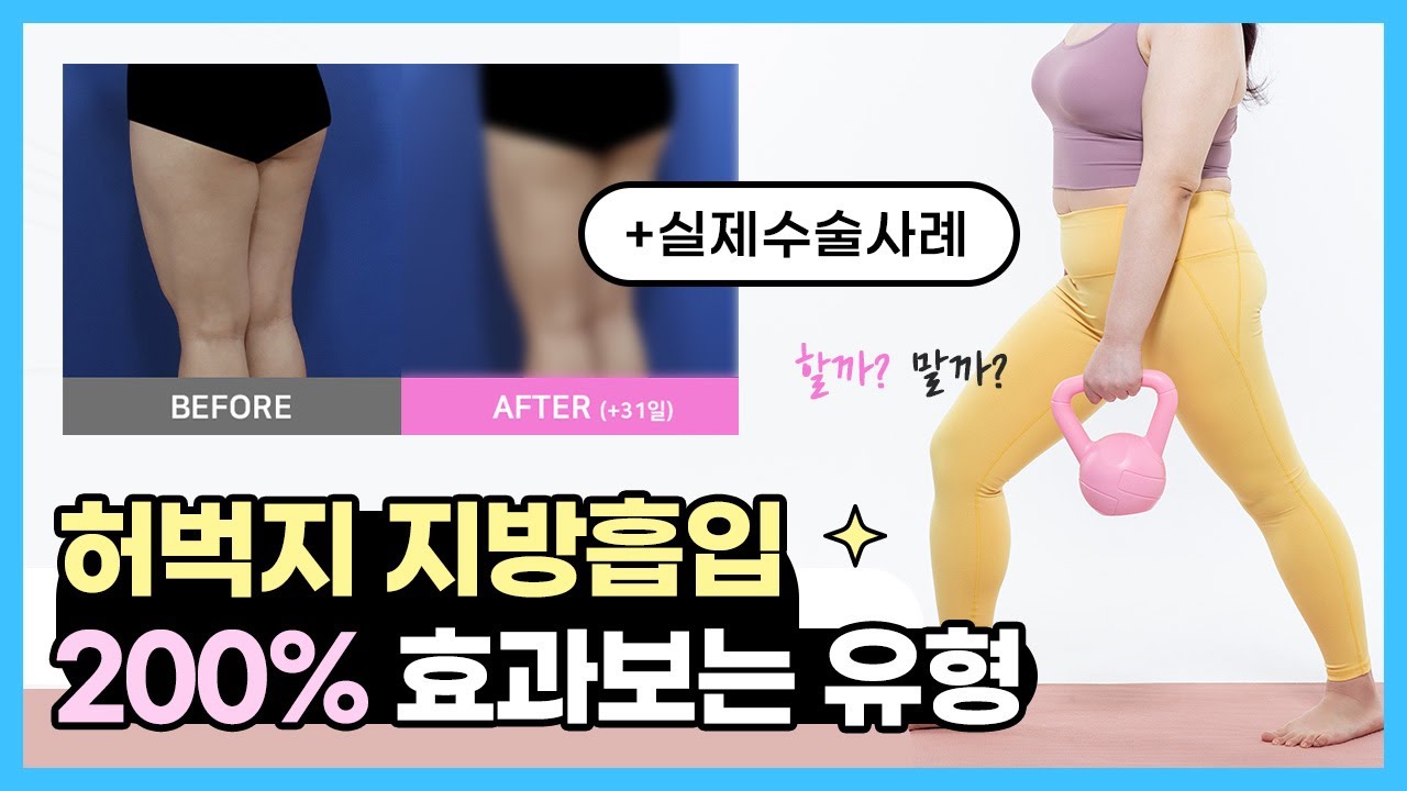 허벅지 지방흡입 200% 효과보는 실제후기🤩 허벅지 얇아지는법 지금 바로 Click!