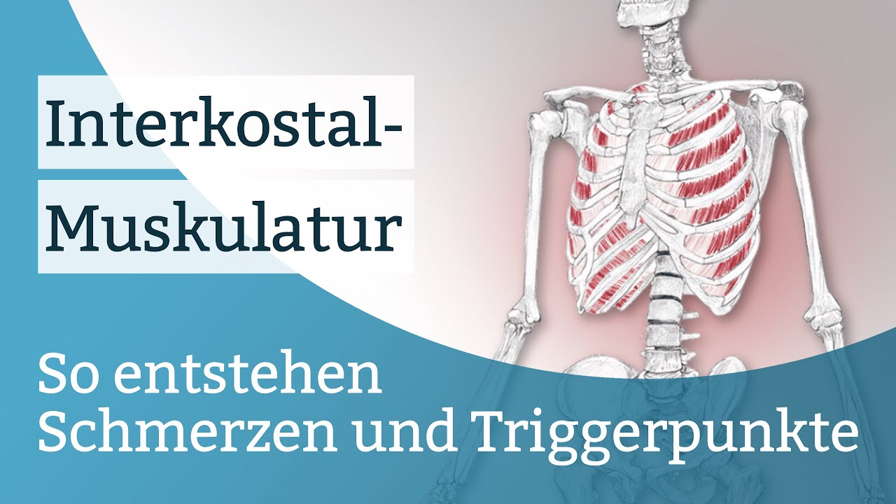 Interkostalmuskulatur Schmerzen, Triggerpunkte und deren Aktivierung