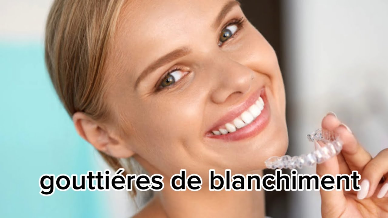 gouttieres de blanchiment haut et bas #prothèse #maroc #dentalprosthesis 