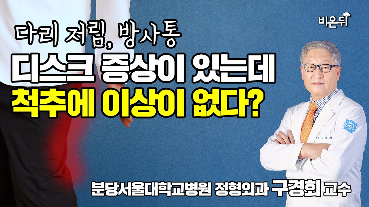다리 저림, 방사통, 디스크라 생각했지만 MRI 결과 척추가 정상이라면? 심부 둔부 증후군을 의심해 보세요. - 분당서울대학교병원 정형외과 구경회