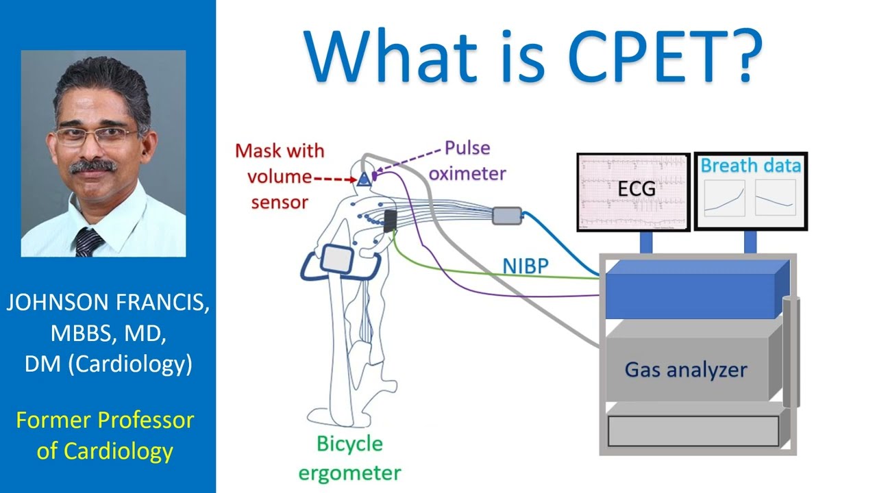 What is CPET?