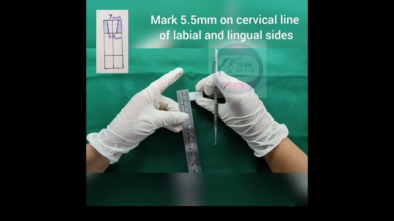 Dental Anatomy Carving - Permanent Mandíbular Canine