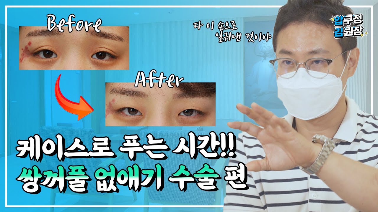 쌍꺼풀없애는수술 실제 환자 사례로 결과 보여드릴께요