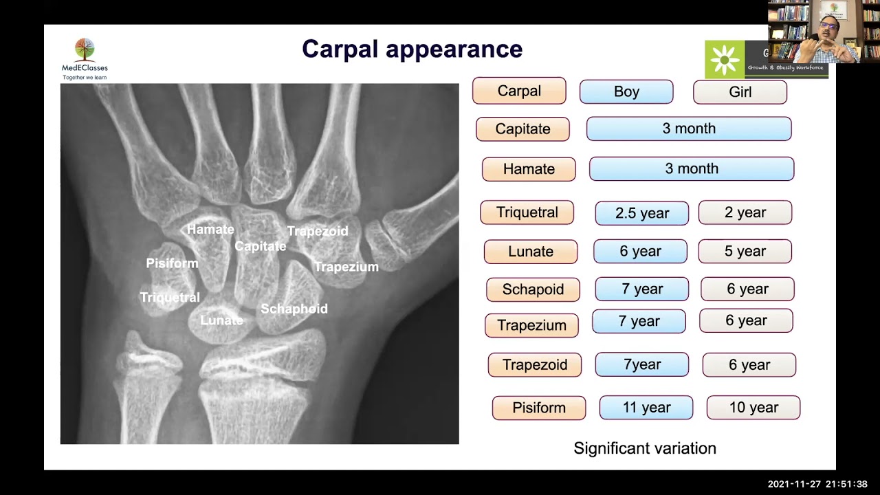 MedEClasses Module Bone Age Assessment