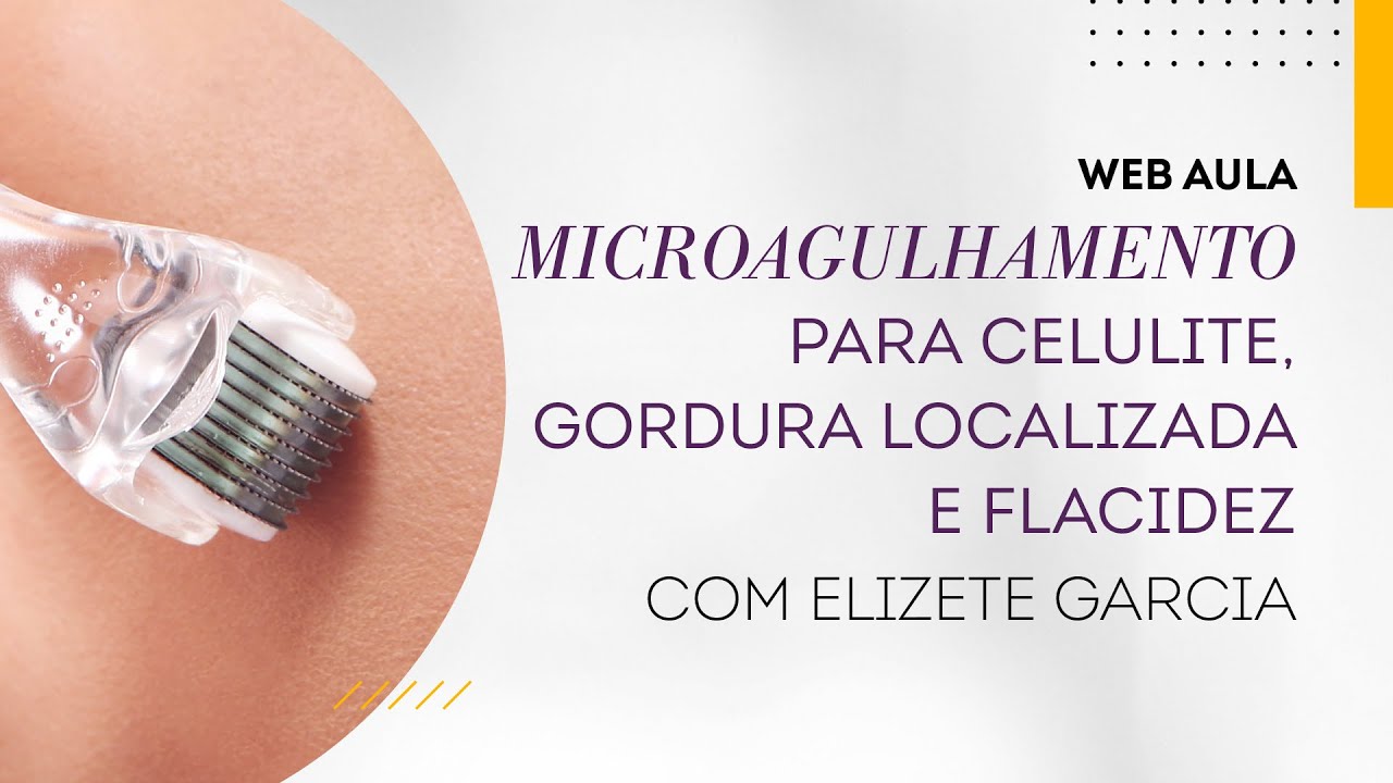 Web aula #050 - Microagulhamento para celulite, gordura localizada e flacidez
