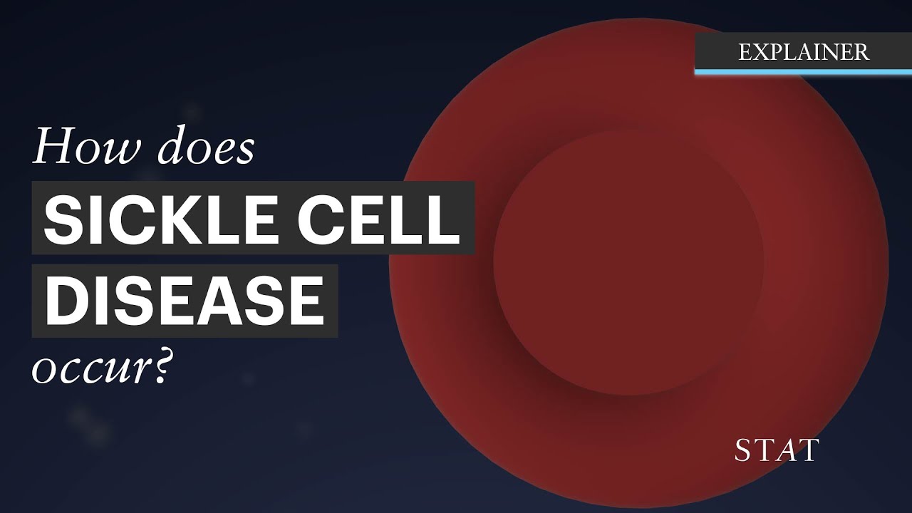 How sickle cell disease happens
