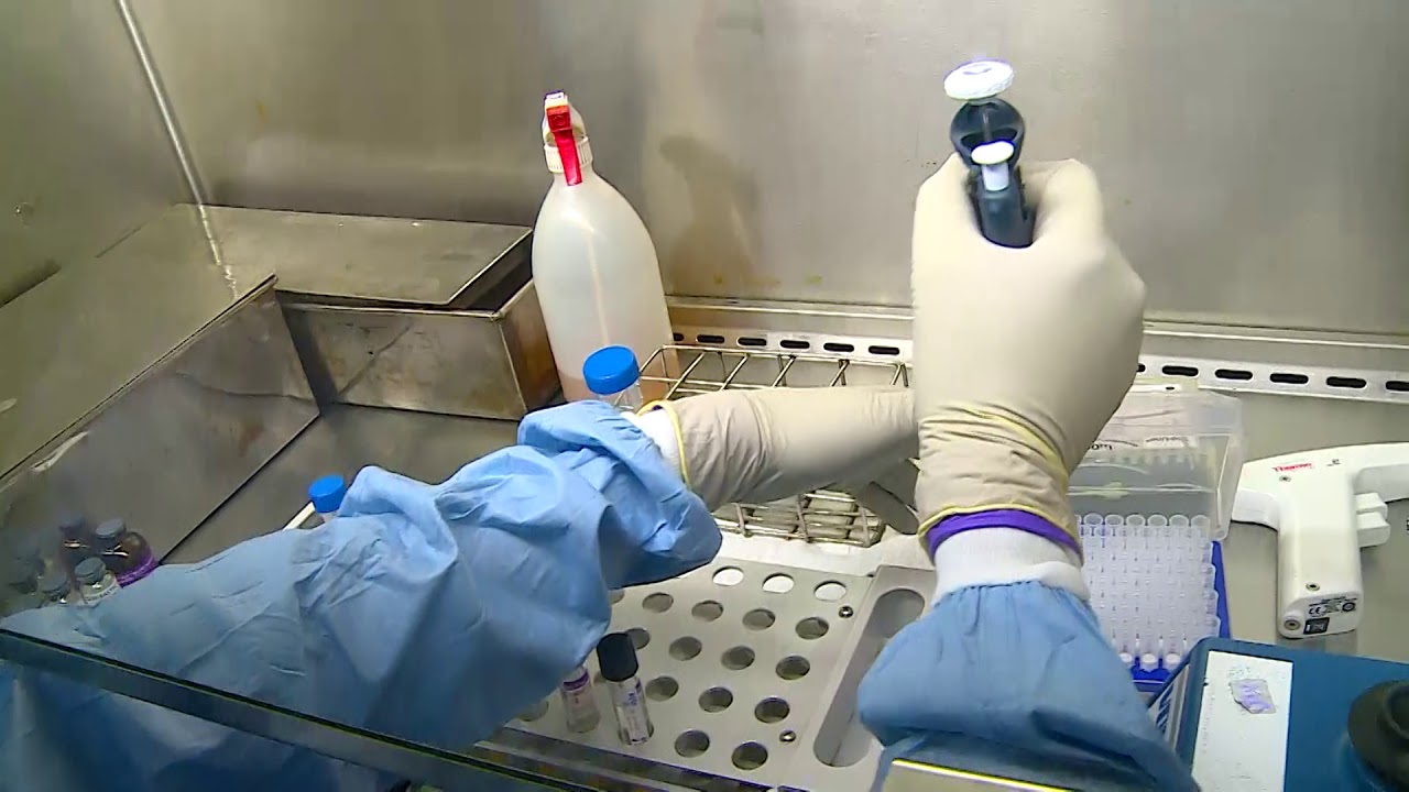 15 Demonstration of drug susceptibility testing of first line anti TB drugs by liquid culture