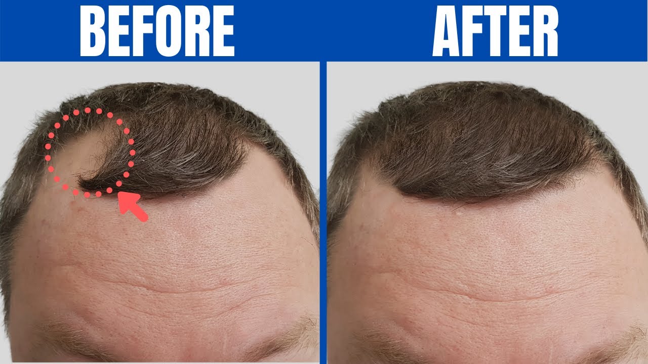 FOODS FOR HAIR GROWTH - 12 Healthy Hair Foods You Should Start Eating Every Day!