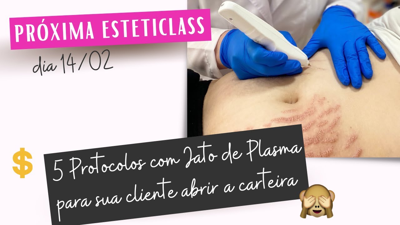 JATO DE PLASMA | 5 Protocolos diferentes com a técnica de jato de plasma!