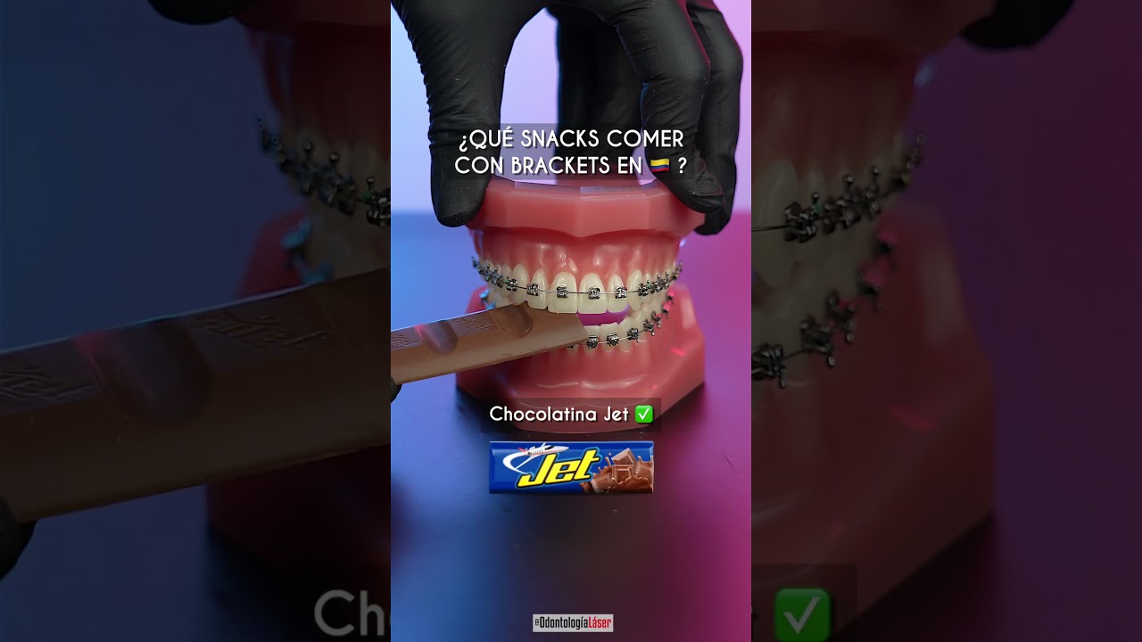 &iquest;Que comer con brackets en 🇨🇴 ? - Odontolog&iacute;a L&aacute;ser #Shorts