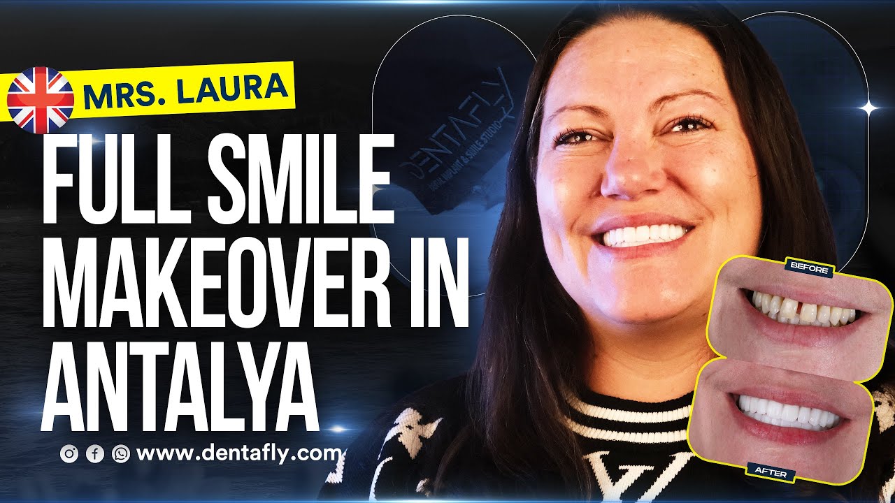 Life-Changing Dental Journey at Dentafly | Full Smile Makeover in Turkey