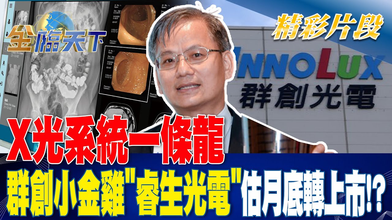 X光系統一條龍 群創小金雞