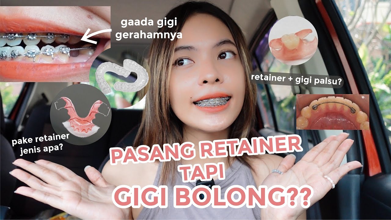PASANG RETAINER BEHEL tapi ADA GIGI YANG HILANG?? EMANG BISA? - Tips Pilih Retainer Behel