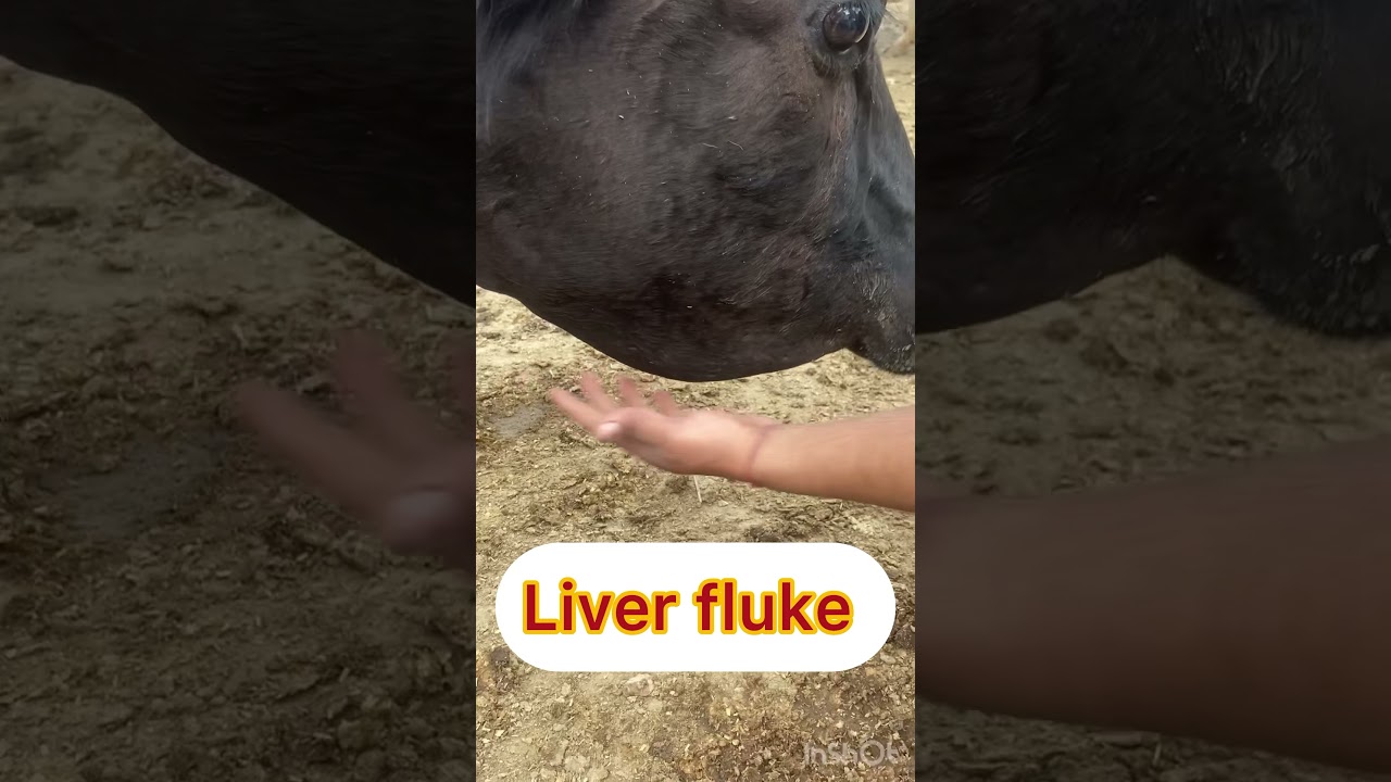 Liver fluke l dr umar khan