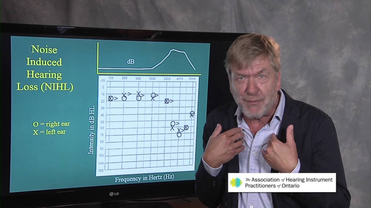 Ted Venema Talks: Noise Induced Hearing Loss