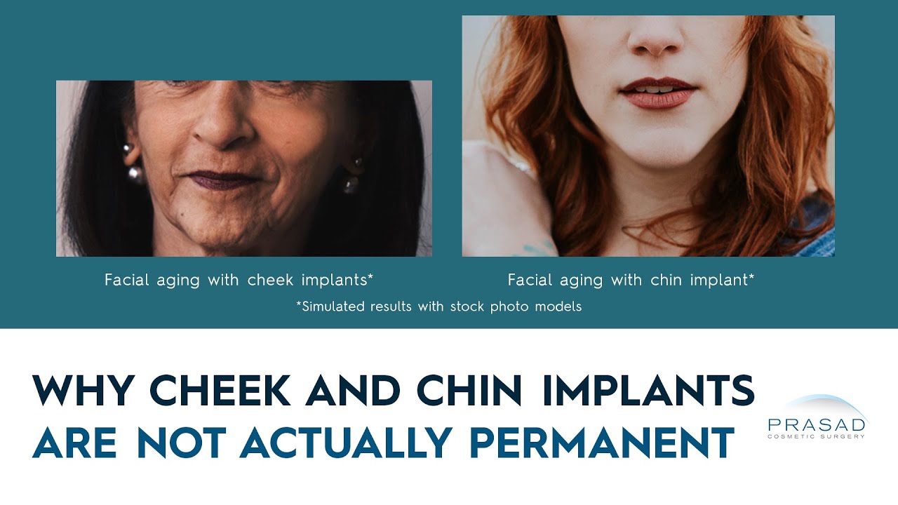 Why Cheek and Chin Implants are Not Permanent