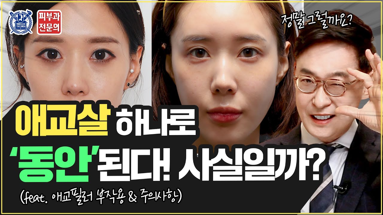 애교살 하나로 동안이 된다고? 정말 사실일까?? (Feat. 예쁜 애교살 만드는 방법 공개! )