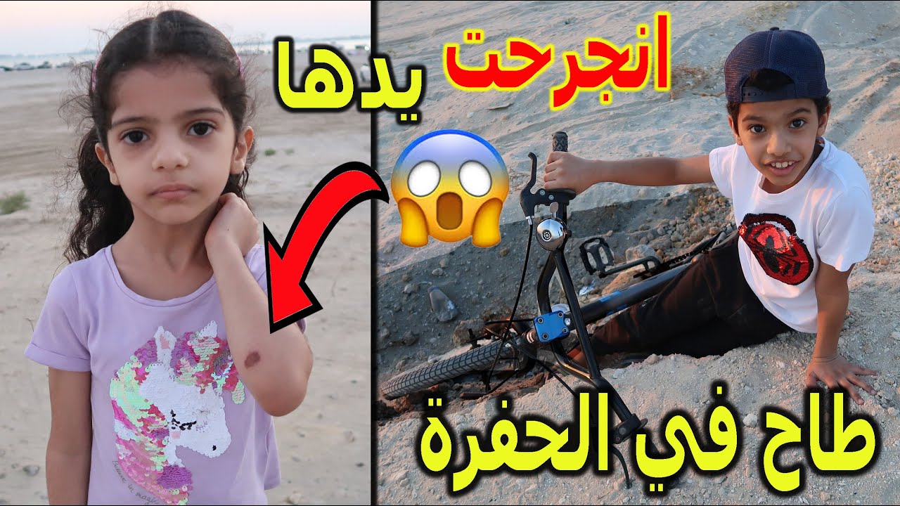تولين انجرحت يدها | دحوم طاح في الحفرة 😢