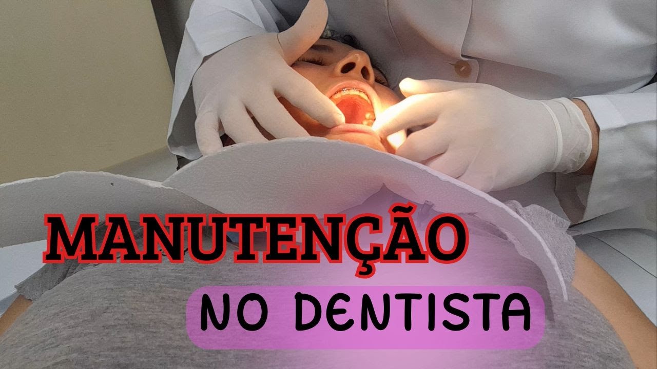 MANUTENÇÃO NO DENTISTA #dentista #dentes #aparelhoortodôntico