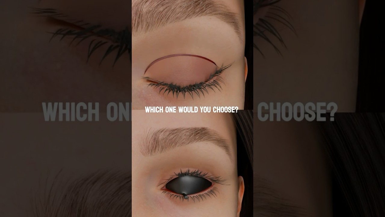 Two different approaches to upper blepharoplasty. Animation by @plastic.touch.