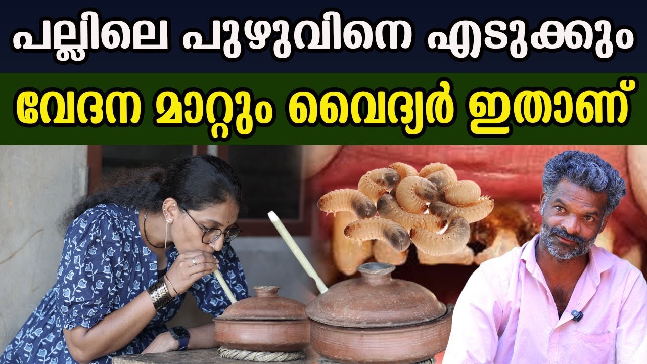 പല്ലിലെ പുഴുവിനെ എടുക്കുന്നത് കണ്ടിട്ടുണ്ടോ മാറാത്ത പല്ലുവേദനയും മാറ്റും ചന്ദ്രൻ വൈദ്യർ