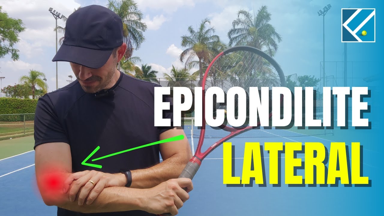 EPICONDILITE LATERAL no tênis - Prevenção e Tratamento   |    Falasca Tennis