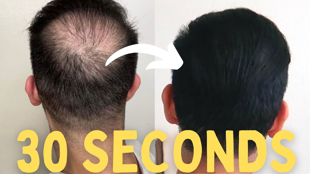 How To Apply Toppik To Your Crown *Less Than A Minute