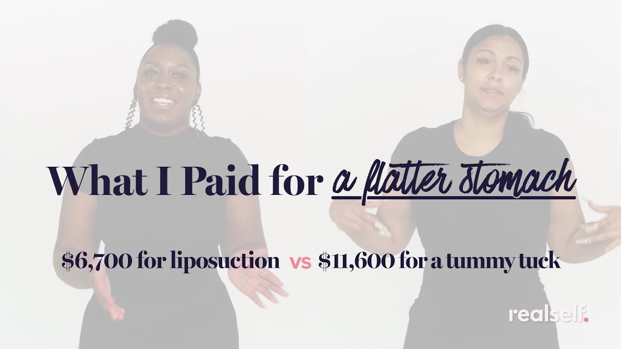 How Much Does Body Contouring Cost? Two Women Share How Much They Paid to Get a Flatter Stomach