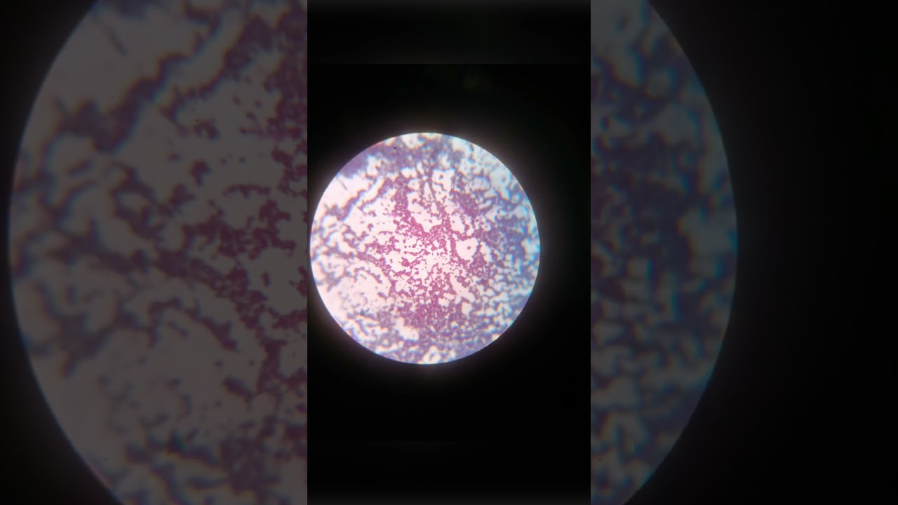 Gram positive# bacteria