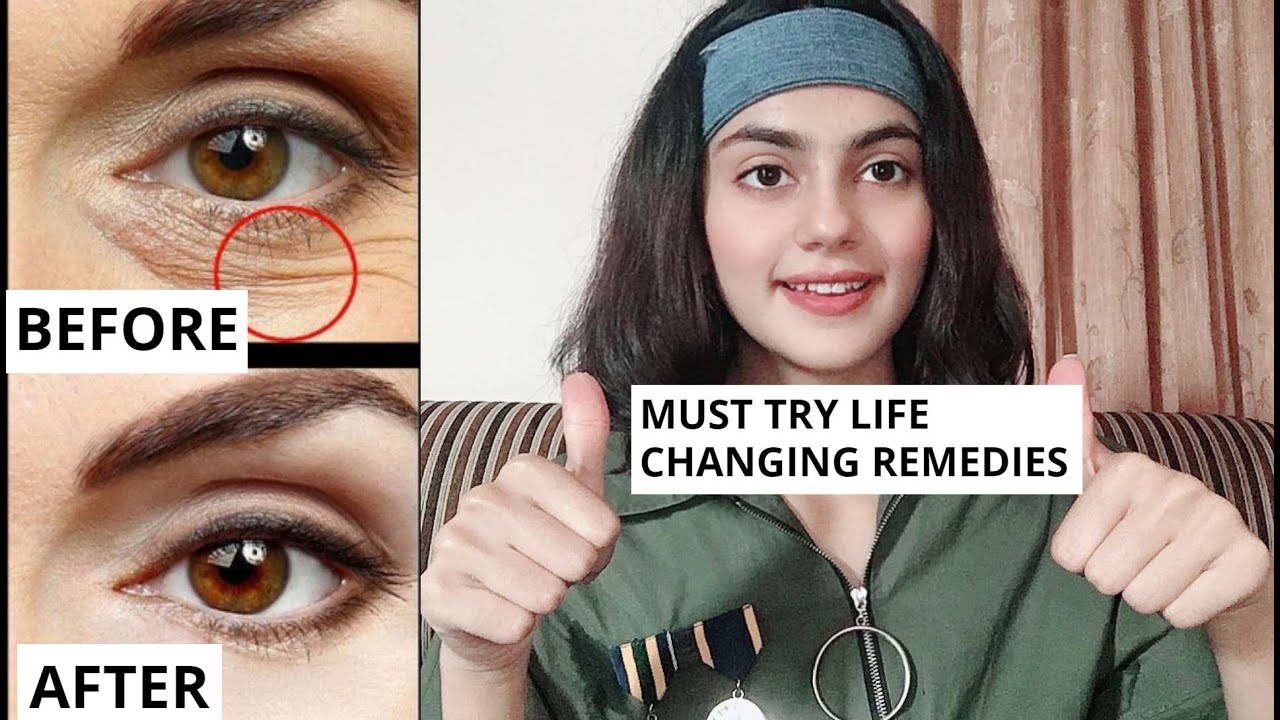 3 - 3 Ingredient Home remedies and poses for Eye Wrinkles, laugh lines | Get rid of Wrinkles on face