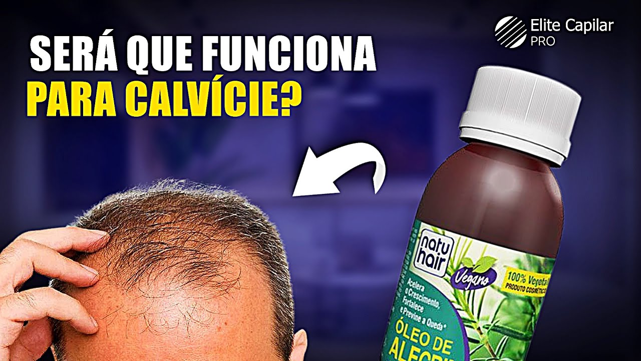 &Oacute;LEOS DA NATUHAIR FUNCIONAM PARA TRATAR QUEDA DE CABELO E CALV&Iacute;CIE?