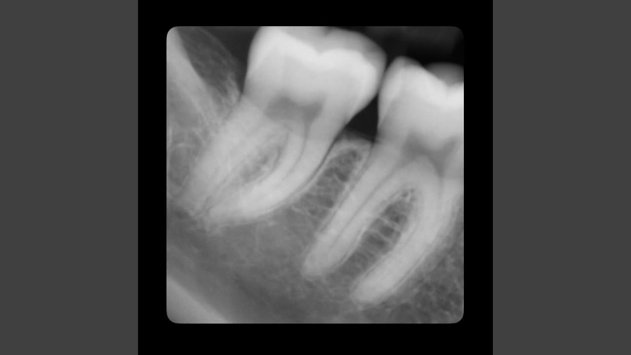 Teeth