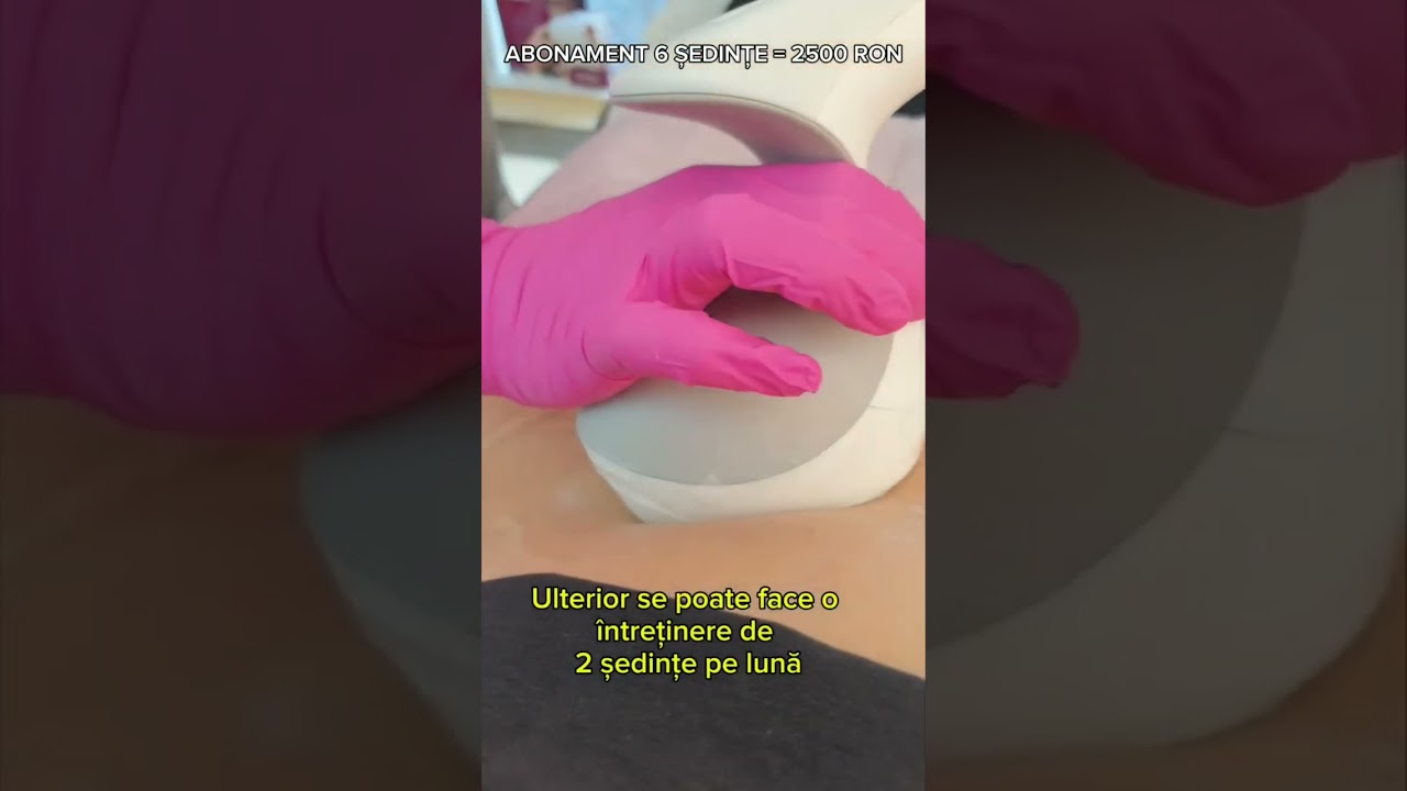 DR KURBE | REMODELARE CORPORALĂ | PRIMA ȘEDINȚĂ