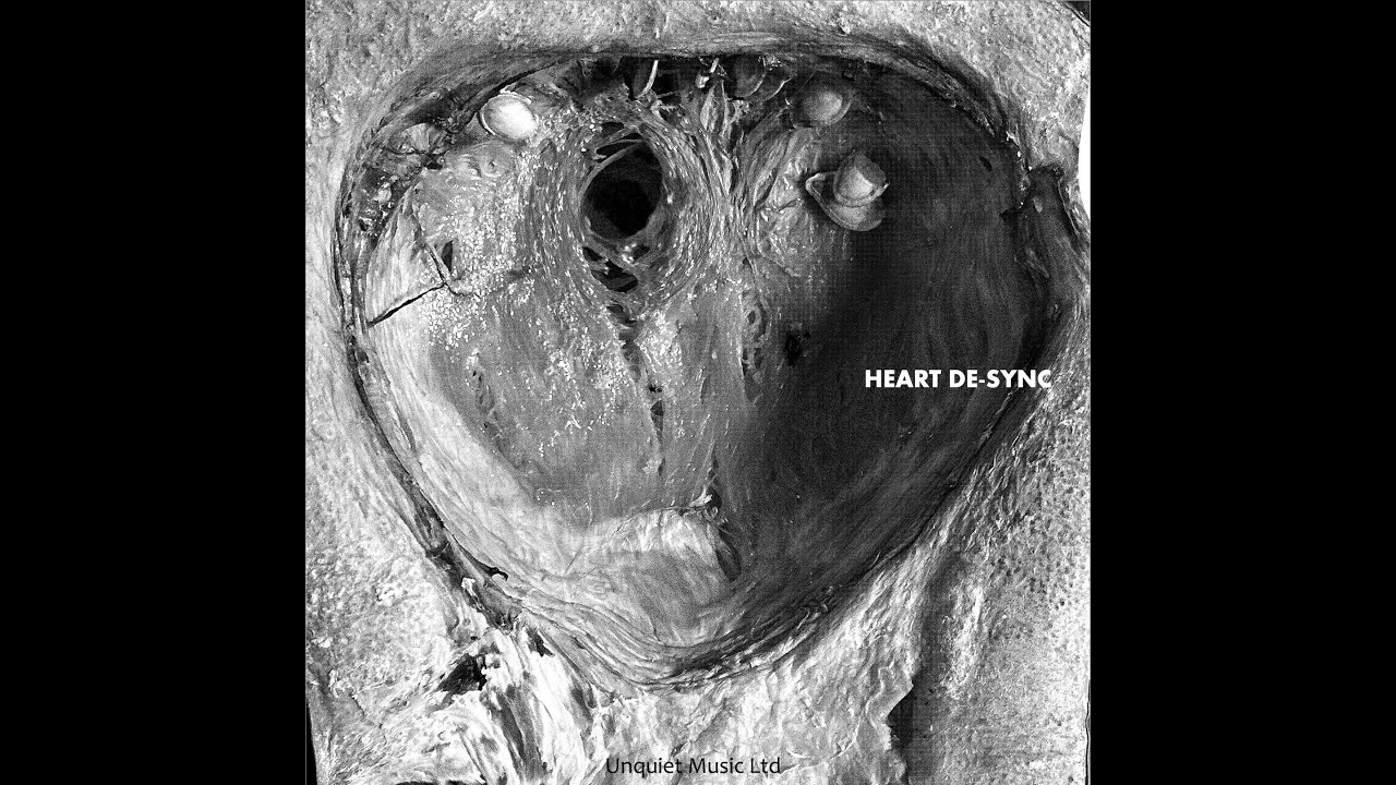 Heart De-Sync