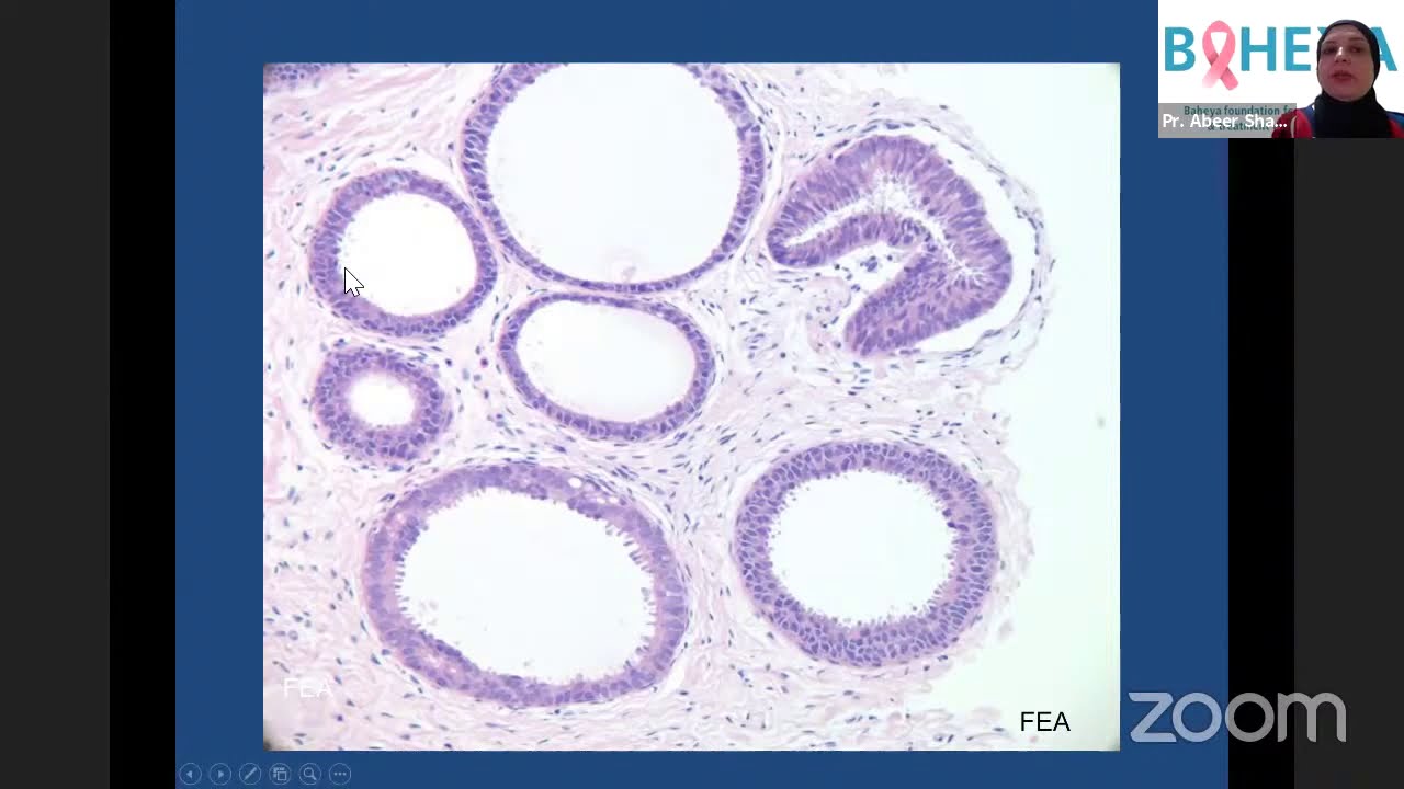 Meet the expert : Webinar 1 - Update on Breast Pathology and approach to diagnoses