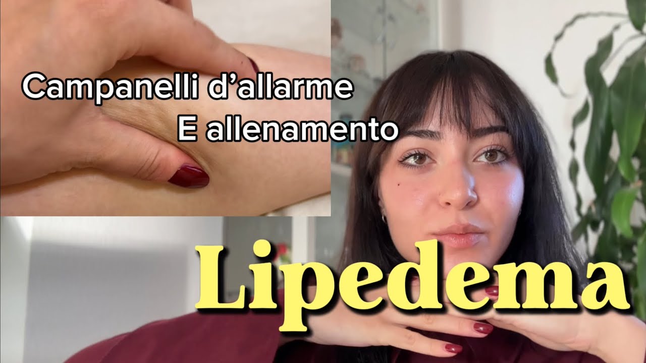 LIPEDEMA allenamento gambe? Quello che ho imparato in questi anni 
