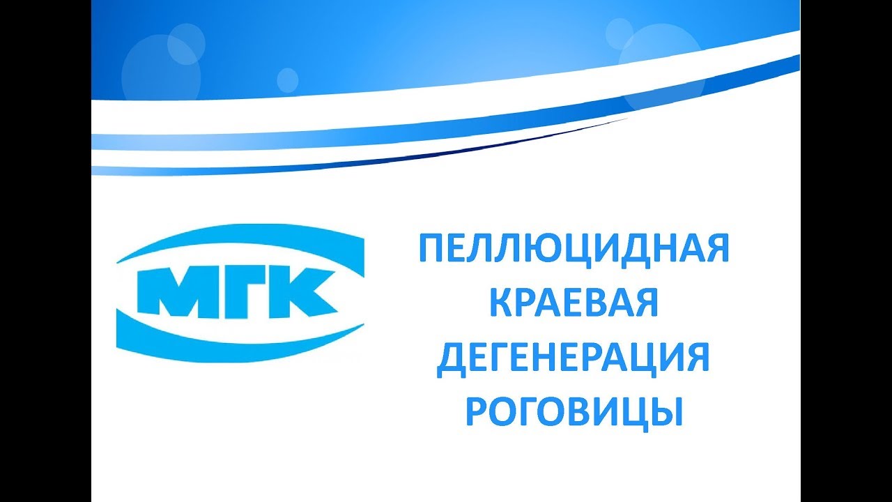 Пеллюцидная краевая дегенерация роговицы