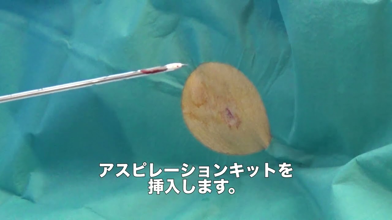 研修医教育ビデオシリーズ⑦　胸腔ドレーン