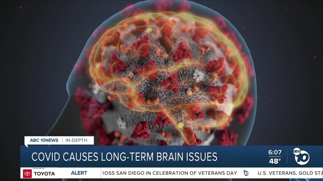 Researchers examine COVID-19's long-term effects on brain