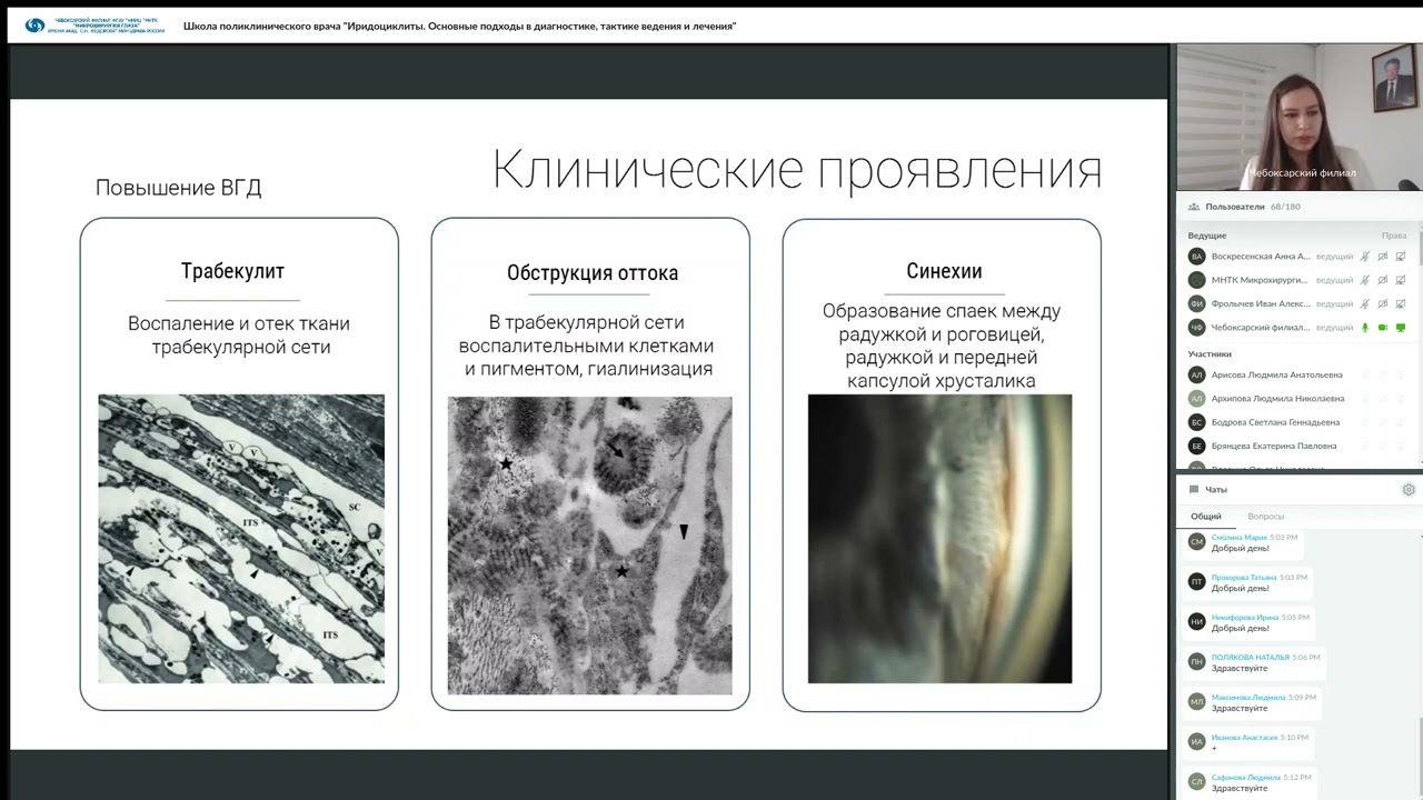 ШПВ Иридоциклиты  Основные подходы в диагностике, тактике ведения и лечения. 18.05.23