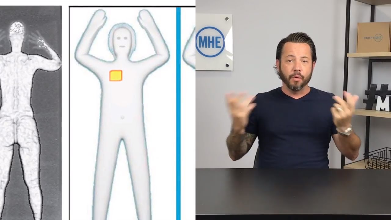 TSA Airport Security And A Hair Replacement, Wig, Hair System.  Is it Ok?