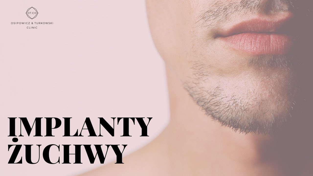 Maskulinizacja żuchwy za pomocą implantów twarzy - OT.CO Clinic