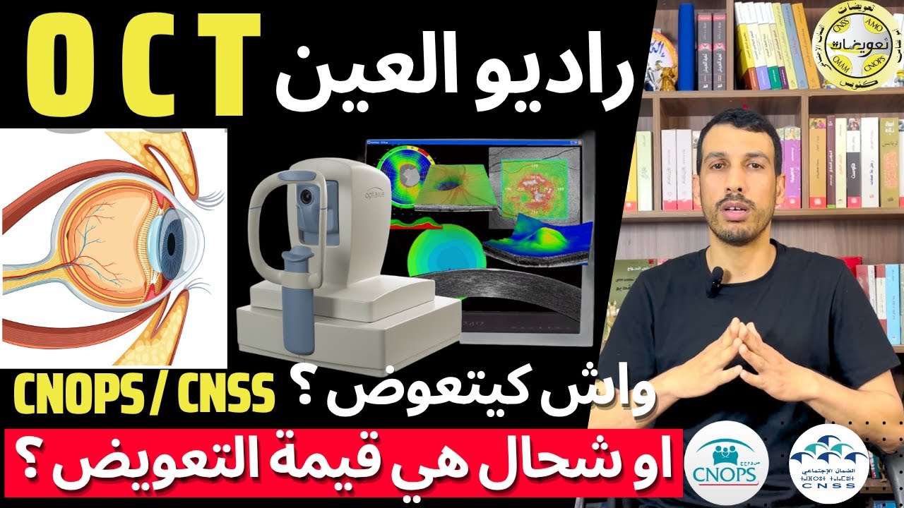 راديو العين OCT | شحال تعويض كنوبس الضمان الاجتماعي سنلام أطلانطا | قرنية مخروطية CNOPS CNSS AMO