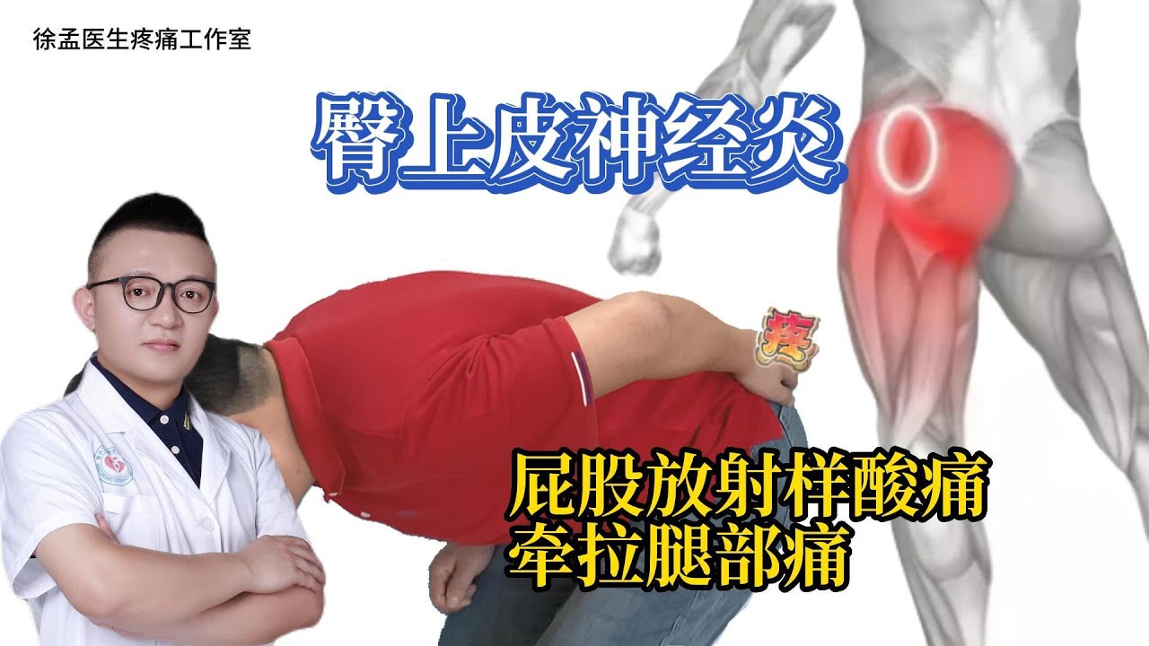 臀上皮神经炎、屁股放射样酸痛、牵拉腿部痛