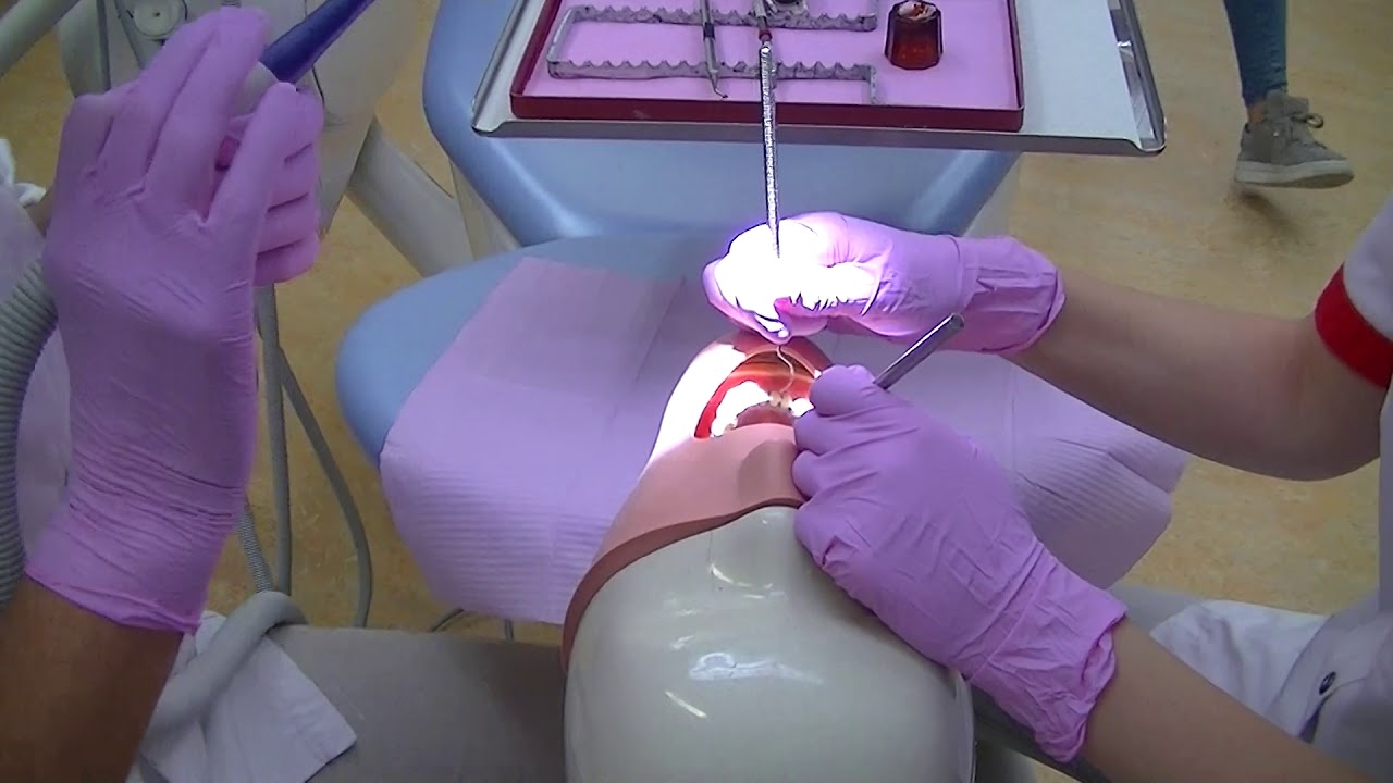 assisteren bij het verwijderen van tandsteen