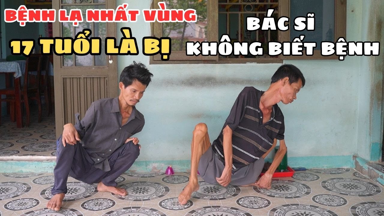 Bí Ẩn Bệnh Lạ Cứ Đến 17 Tuổi Không Ai Di Chuyển Bình Thường Chưa Rỏ Nguyên Nhân