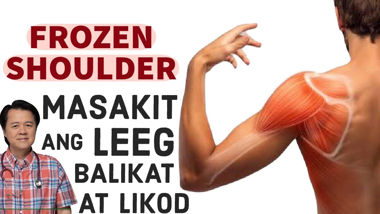 Frozen Shoulder: Masakit ang Leeg, Balikat at Likod - Payo ni Doc Willie Ong #184b