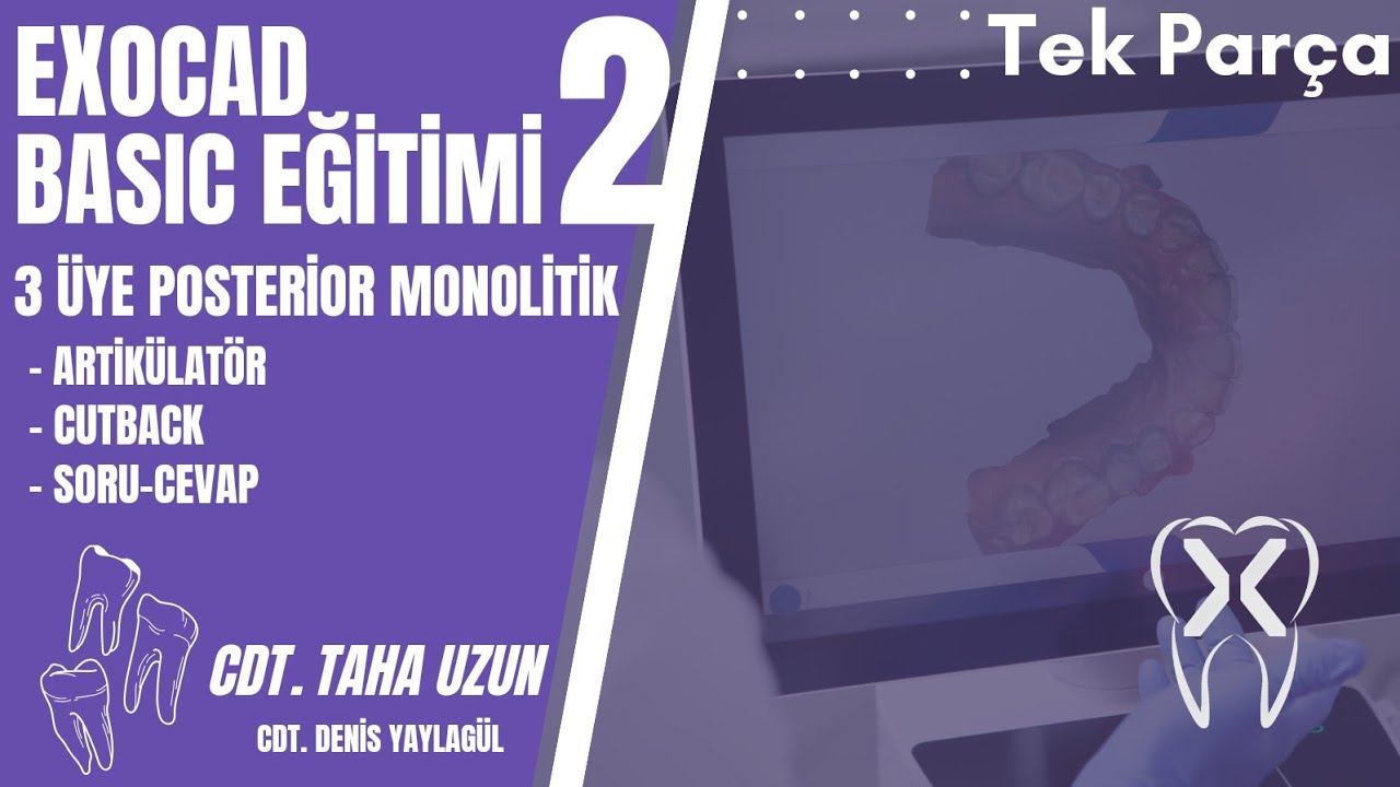 Exocad Basic Eğitimi 2 || Tek Parça || 3 Üye Posterior Monolitik